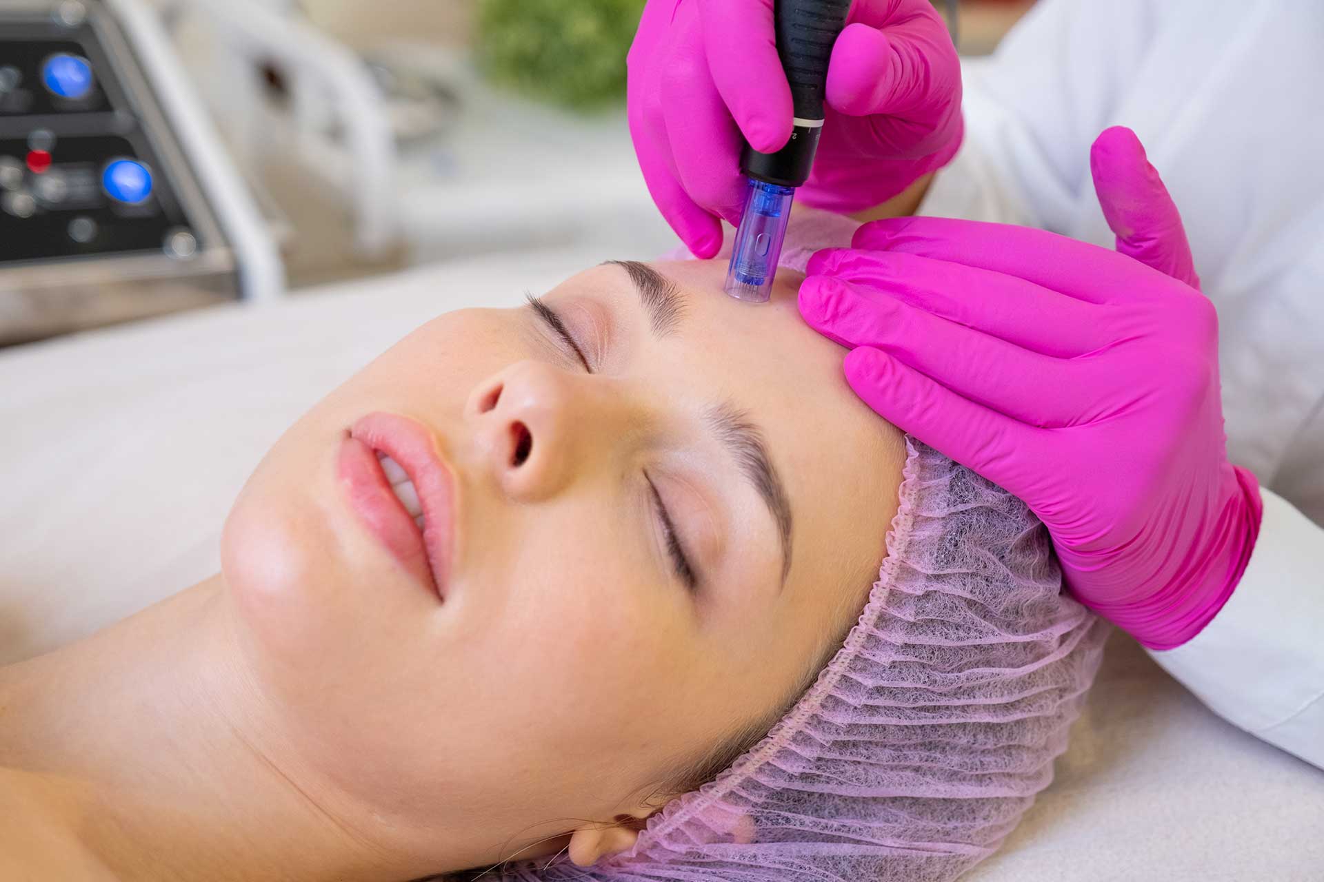 Symmetry Skin Needling