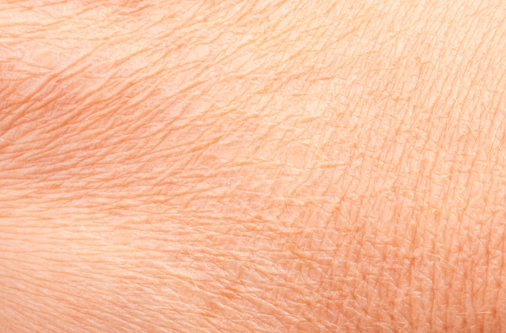 Crepey Skin