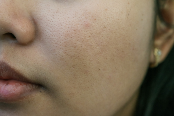 Open Pores 2 Open Pores