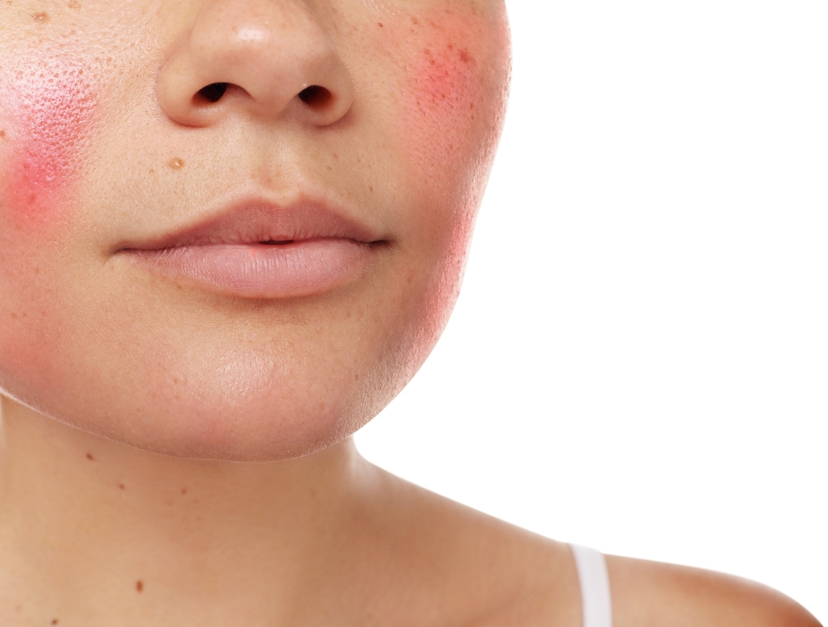 Sensitive Skin 2 Sensitive Skin