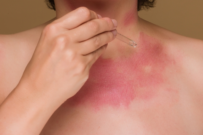 Sensitive Skin