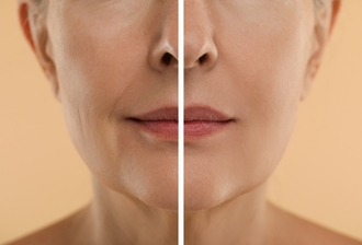 Signs Of Ageing