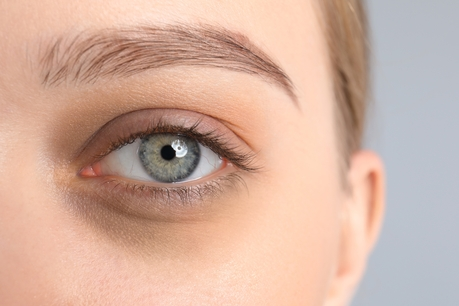 Under Eye Circles 2 Under Eye Circles