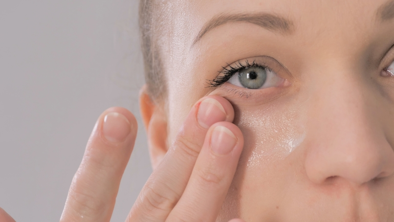 Under Eye Circles 1 Under Eye Circles
