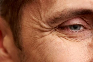 Wrinkles 2 Wrinkles