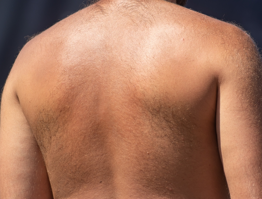 Back Wax 1 Back Wax