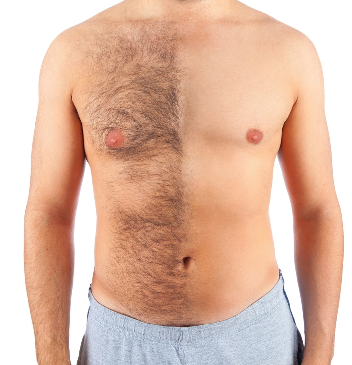 Chest & Shoulders Wax 1 Chest & Shoulders Wax