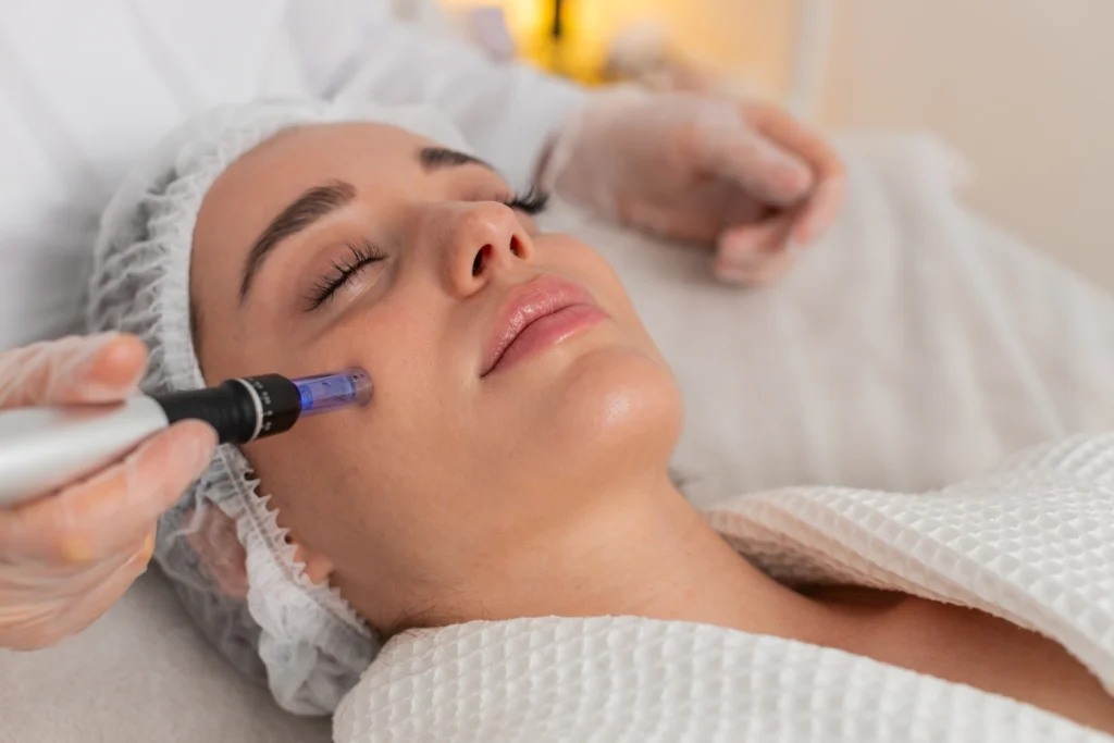 Skin Needling