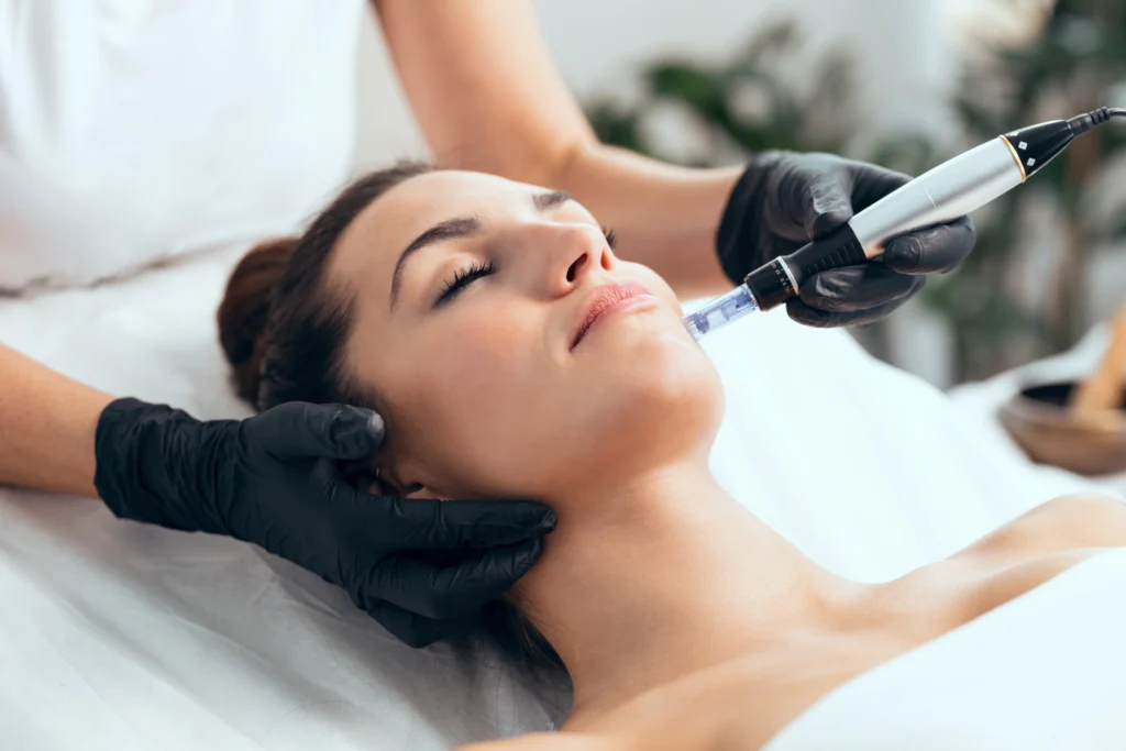 skin needling 2 50 1 50