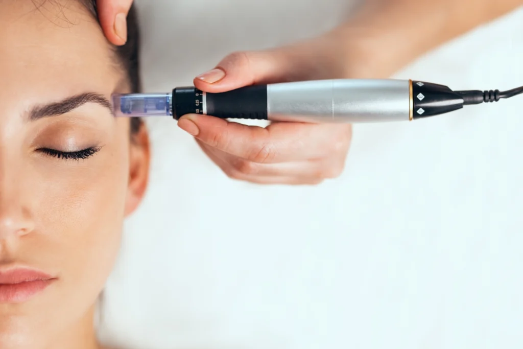 Skin Needling 2 skin needling 50 1 50