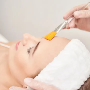 blemish control peel 01 (1)